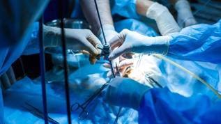 Doktorlar gözlerine inanamadı! 61 yaşındaki kadının beyninden 8 santimetrelik parazit çıkarıldı