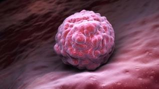 Kanser neden tedaviye dirençli oluyor? Bilim insanları kritik süreci açıkladı