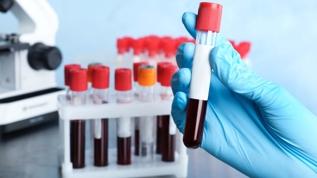 Yeni kan testiyle %99 doğruluk! Uyku eksikliği artık gizlenemiyor