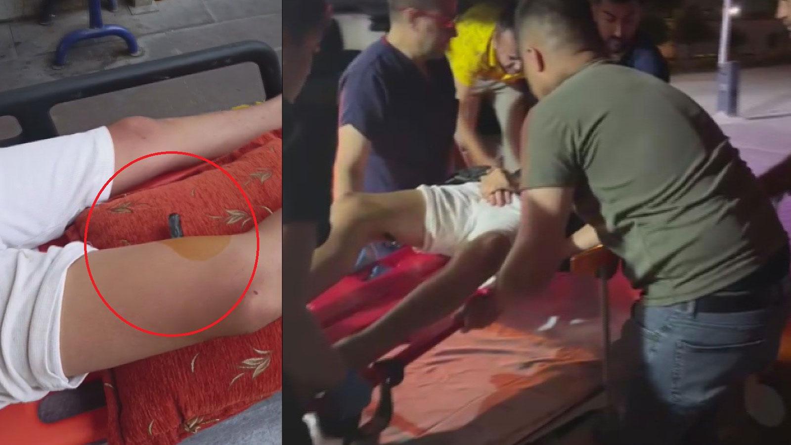 Hatay'da 14 yaşındaki çocuğun bacağına korkuluk demiri saplandı