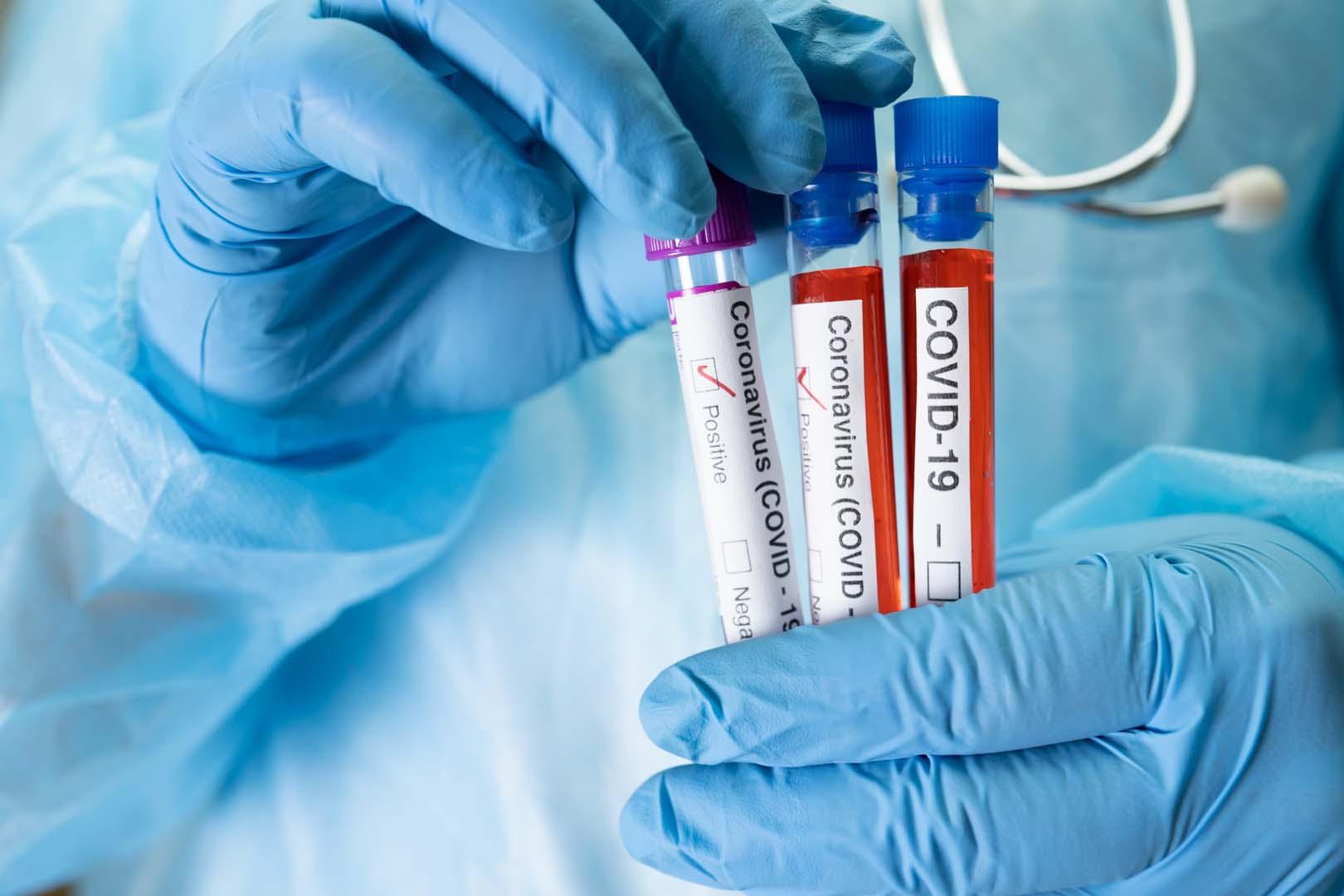Milyonlarca kişi risk altında! COVID eski virüsleri uyandırıyor