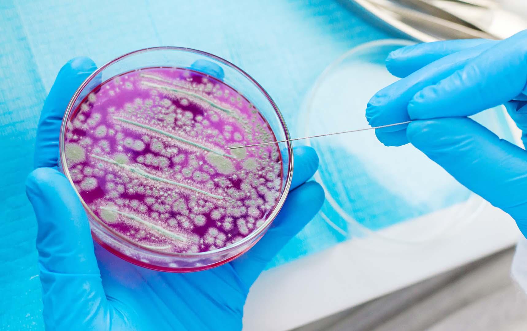 Ölümcül ilaç dirençli mantar Candida auris ciltte nasıl saklanıyor? Bilim insanları mekanizmayı ortaya çıkardı