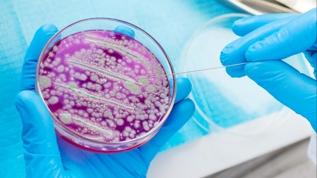 Ölümcül ilaç dirençli mantar Candida auris ciltte nasıl saklanıyor? Bilim insanları mekanizmayı ortaya çıkardı
