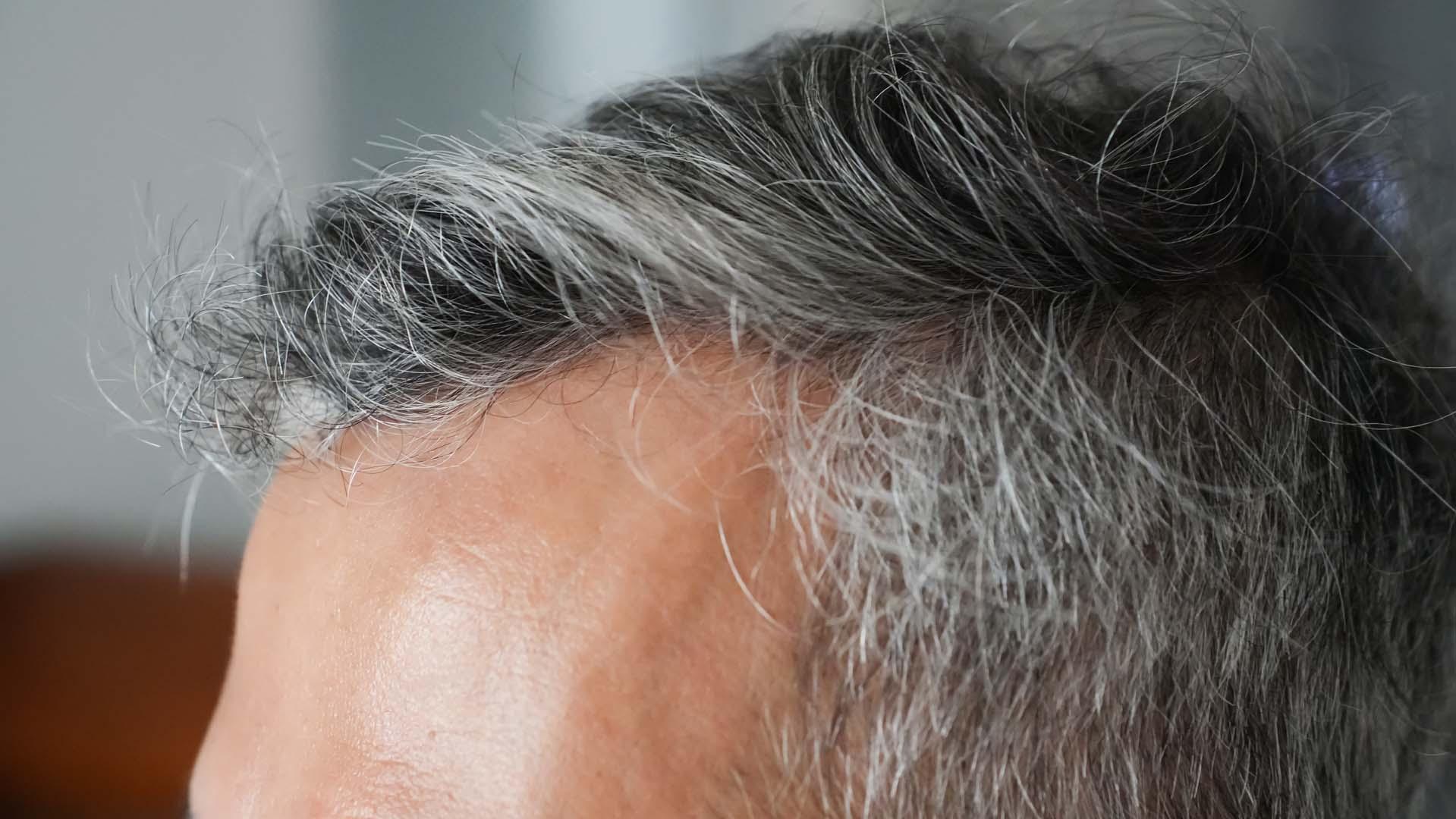 Saçlar neden beyazlıyor? Bilim insanları yıllardır süren soruya yeni bir yanıt buldu