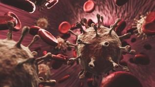 Kanserin gözden kaçan 7 belirtisine dikkat! Vücudunuzdaki değişiklikleri hafife almayın