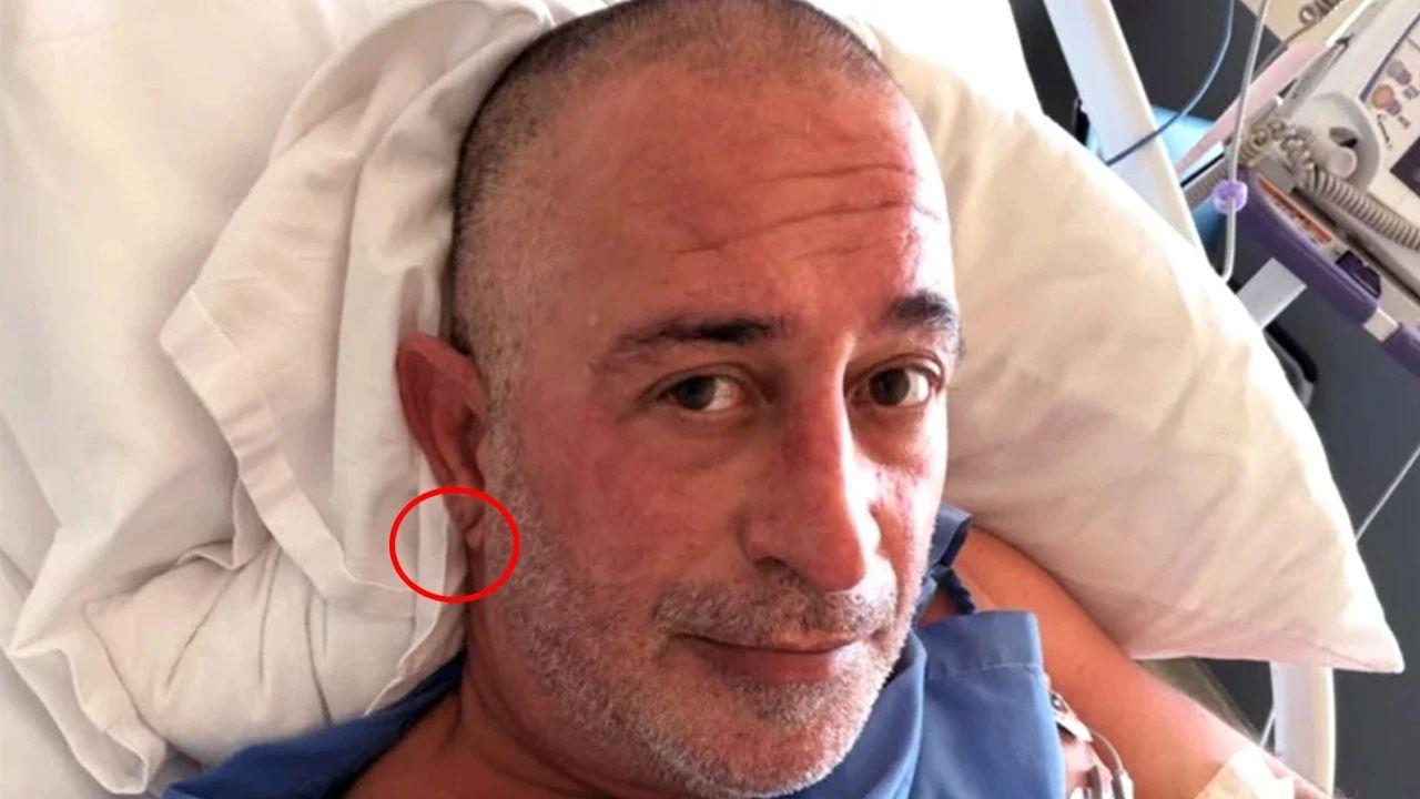 Cem Yılmaz'ın kalp kriziyle gündeme geldi: Kulaktaki 'Frank işareti' gerçekte ne anlama geliyor?
