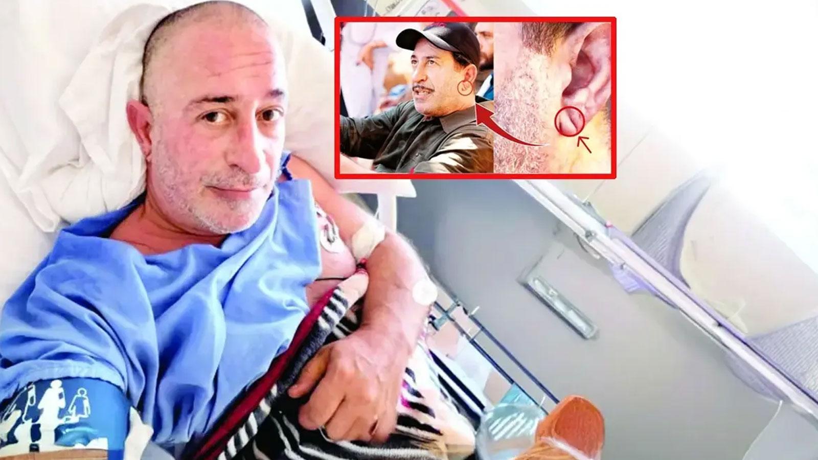 Kalp krizi belirtisi olabilir mi? ‘Frank işareti' tartışması
