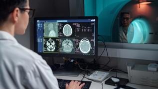 Yüksek tansiyonu düşürmenin beyin için de faydası ortaya çıktı! MRI taramaları dikkat çekici değişimi gösterdi