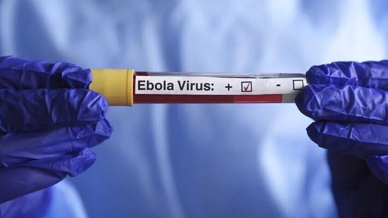Kenya'da Ebola vakası sayısı 8'e yükseldi