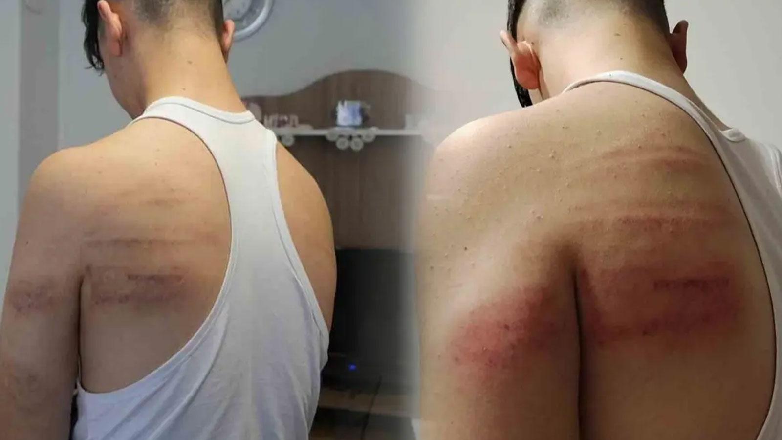 Çırağını darp ettiği iddia edilen berber tutuklandı