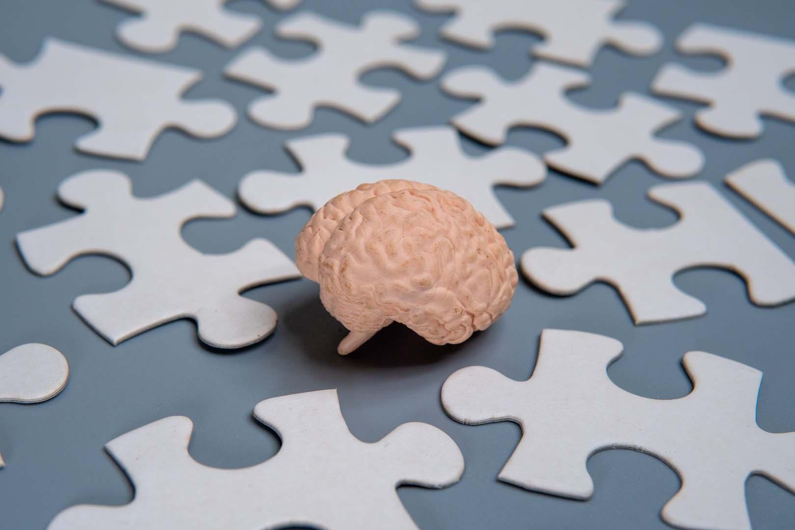 1970'lerden kalan kalp tedavisi ezber bozdu! Alzheimer hastalarında kayıp hafızayı 2 yıl geriye sardı
