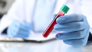 Depresyonun kanda tespit edilmesini sağlayan test bulundu!