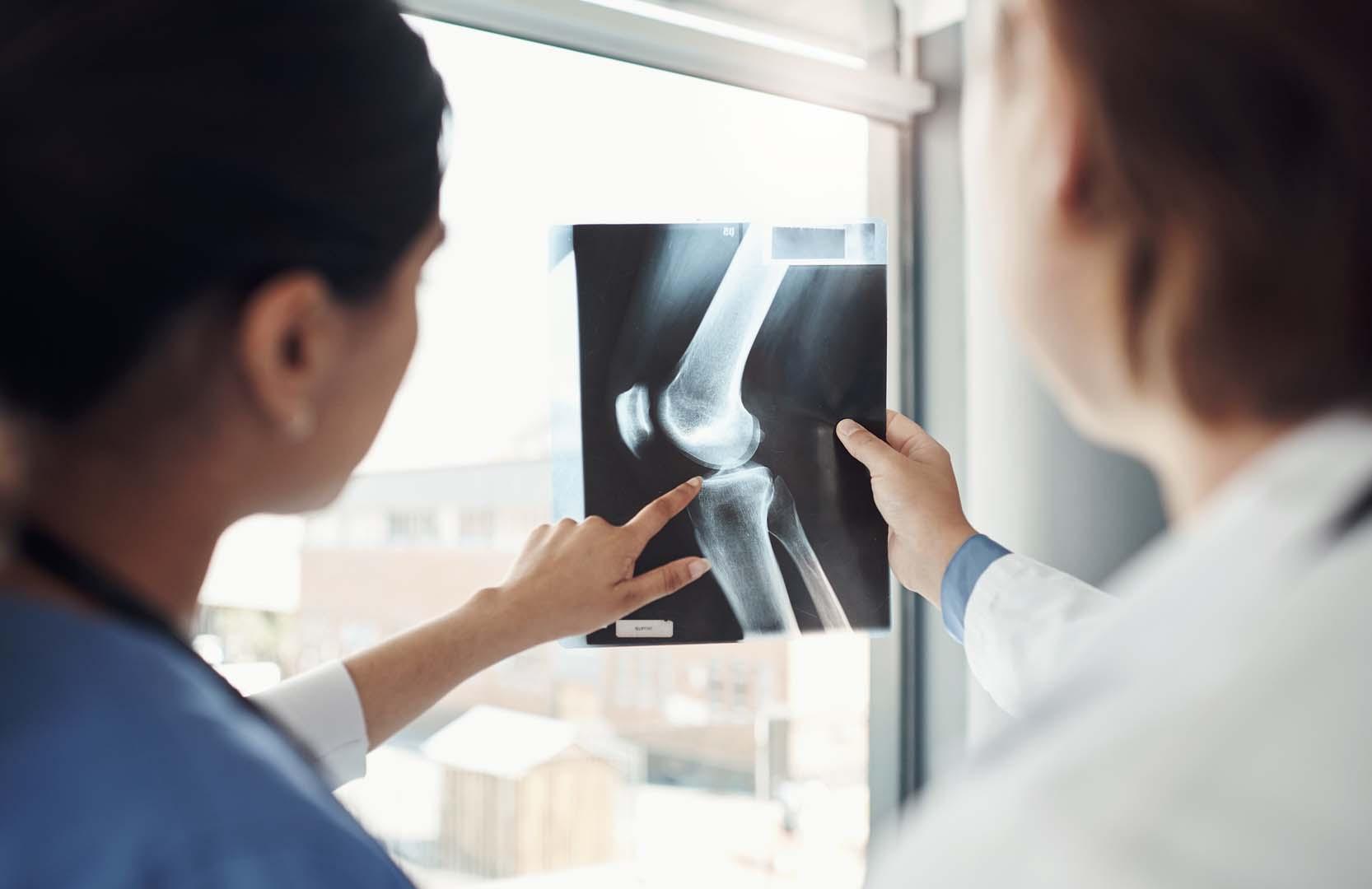 Kadın sağlığında ezber bozan testosteron araştırması