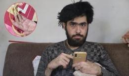 23 yaşındaki genç hayatını ekrana hapsetti! 3 yıldır evden çıkmıyor