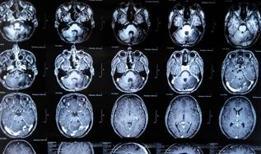 Beynin dili çözüldü! Allen Enstitüsü'nden devrim niteliğinde keşif