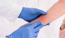 Egzamanızı tetikleyen 8 alışkanlık! Bu hatalar cildinizi tehdit ediyor