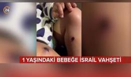 1 yaşındaki bebeğe İsrail vahşeti!