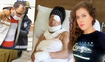 Eski sevgilisi vücuduna kezzap atmıştı! Yaşadığı acı tecrübeyi anlattı böyle anlattı