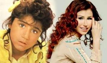 'Küçük Ceylan' artık tarih oldu! Estetik sonrası yeni yüzü şoke etti