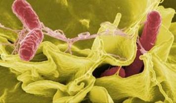 Parkinson hastalığı bağırsak bakterileriyle bağlantılı olabilir...