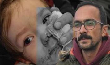 Ankara'da pitbull saldırısına uğrayan çocukların babası çağrıda bulundu!