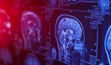 Böbreklerdeki bu işaret beyinde hasar olup olmadığını gösterebilir