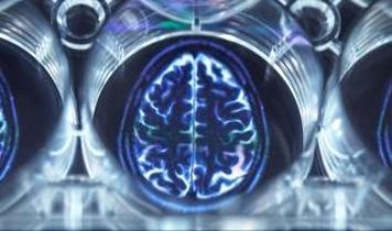 Bilim insanları psikotik bozuklukların ardındaki 'beyin depremi' mekanizmasını ortaya çıkardı