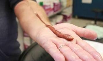 Kayıtlardaki en yaşlı şerit solucanı 30 yaşında olduğu ortaya çıktı