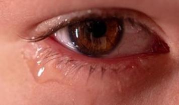 Kuru göz hastalığının tedavisi için laboratuvarda yetiştirilen gözyaşı bezleri umut veriyor