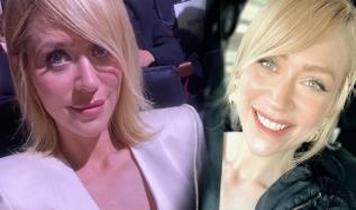 Hazal Türesan'ı bu fotoğraflarda tanıyabildiniz mi? Estetiksiz hali resmen bambaşka biriymiş...