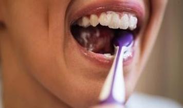 Ağız hijyeni ile demans arasında bağlantı bulundu