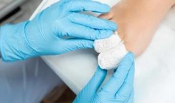 Diyabet yaralarının iyileşmemesinin nedeni ortaya çıktı