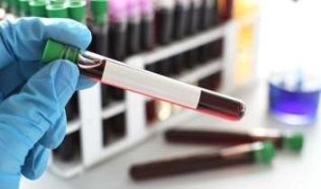 Kan testiyle kanser tespiti devrim olabilir ama büyük bir sorun var