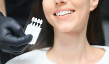 Diş beyazlatma hakkındaki büyük yalan! Doktor gerçeği tek tek anlattı