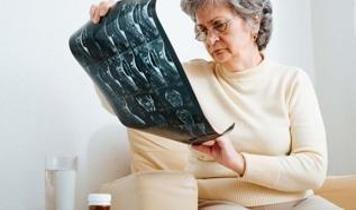 50 yaş üstü kadınlarda kemik erimesi riski artıyor! Hangi gıdalar koruyor?