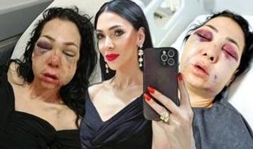 "Küfür etmeyin" dedi tanınmaz hale geldi! Oğlunun önünde eşkıya dayağı