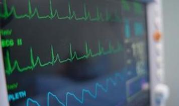 Kalp ritmi tedavisinde çığır açan başarı sağlandı