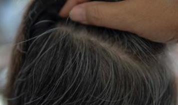 Bilim insanlarından dikkat çeken uyarı! Gri saç sadece yaşlanma belirtisi değil