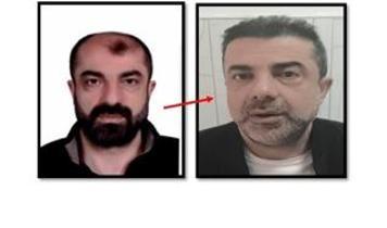 Yüzünü değiştirmesi de yetmedi! 7 yıllık firari ülkeye girer girmez enselendi