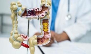 Binlerce hasta incelendi! Bağırsak geçiş süresi sağlığı nasıl etkiliyor?