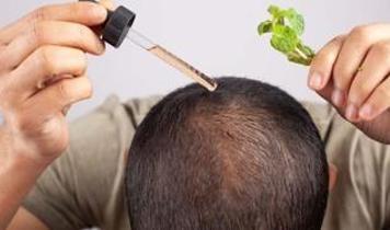 Saç dökülmesine çözüm bulundu mu? Yeni saç serumu ne kadar etkili?