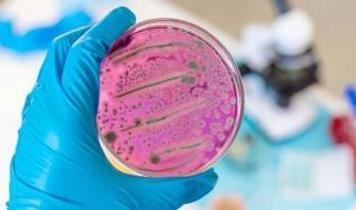 Görünmeyen tehlike! Bakteriler kimyasalları saklıyor