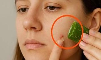 Aloevera ile ciltte mucize değişim: 5 önemli katkı