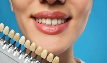 Dişlerin rengini sadece kahve ve çay değiştirmiyor! Uzman listeyi açıkladı