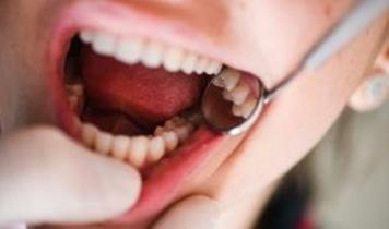 Tıp dünyasında devrim! Saniyeler içinde sürülen sıvı çürüğü anında durduruyor